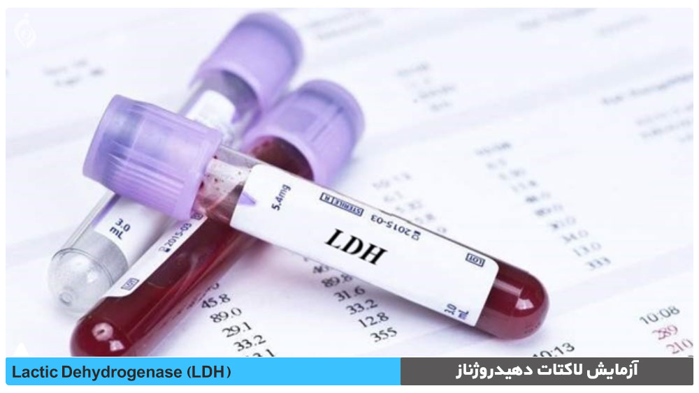مروری بر آزمایش LDH