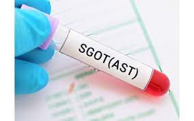 آزمایش SGOT - AST